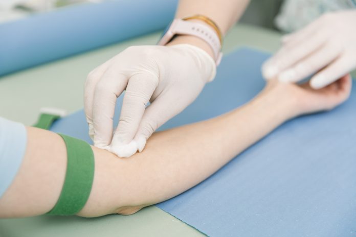 Taking,A,Blood,Test,From,A,Vein,In,The,Treatment