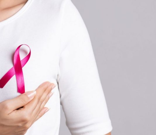 Cáncer de mama: más de 2.600 personas tienen garantías GES retrasadas mientras los nuevos casos superan los 5 mil al año